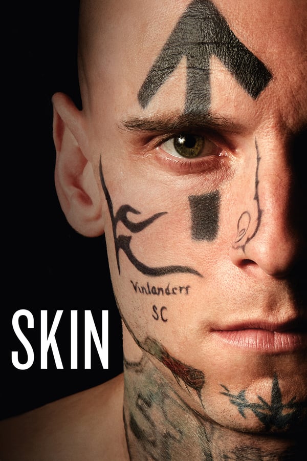 ES - Skin