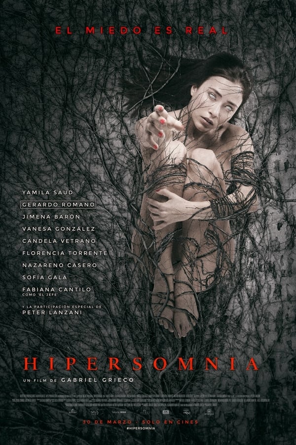 SE - Hypersomnia