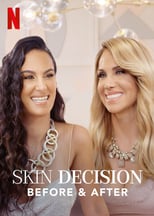 NF - Skin Decision: Before and After